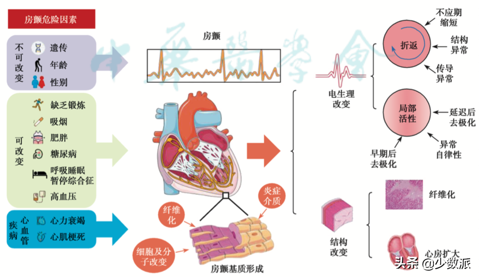 apple watch心电图准不准？-第6张图片